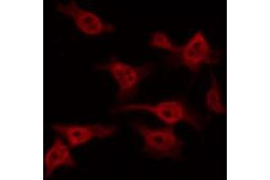 Immunofluorescence (fixed cells) (IF/ICC) image for anti-PTK2 Protein tyrosine Kinase 2 (PTK2) (pTyr576) antibody (ABIN6256766)