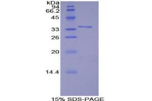SDS-PAGE analysis of Human TRAF6 Protein. (TRAF6 Protein)