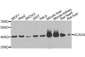 Western blot analysis of extracts of various cells, using ACADS antibody. (ACADS Antikörper)
