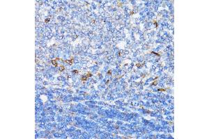 Immunohistochemistry of paraffin-embedded rat spleen using NDE1 antibody (ABIN5974277) at dilution of 1/100 (40x lens). (NDE1 Antikörper)