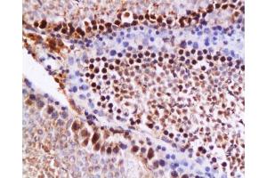 Immunohistochemistry (Paraffin-embedded Sections) (IHC (p)) image for anti-Caspase 12 (Gene/pseudogene) (CASP12) (AA 201-300) antibody (ABIN737736)