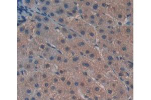 Used in DAB staining on fromalin fixed paraffin- embedded liver tissue (GTF2H5 Antikörper  (AA 1-71))