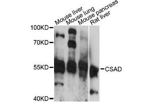 Western blot analysis of extracts of various cell lines, using CSAD antibody (ABIN6294199) at 1:3000 dilution. (CSAD Antikörper)