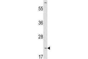 Western blot analysis of VHL antibody and HepG2 lysate. (VHL Antikörper  (AA 43-71))