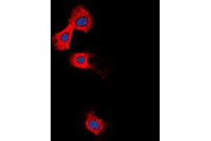 Immunofluorescent analysis of MMP11 staining in Raw264. (MMP11 Antikörper  (Center))