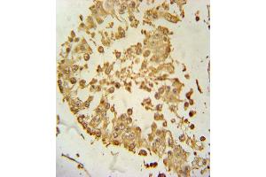 ZDHHC21 Antibody (N-term) (ABIN651365 and ABIN2840203) immunohistochemistry analysis in formalin fixed and paraffin embedded human testis tissue followed by peroxidase conjugation of the secondary antibody and DAB staining.