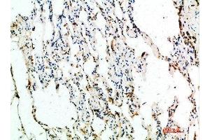 Immunohistochemical analysis of paraffin-embedded human-lung, antibody was diluted at 1:200 (ASCL1 Antikörper  (AA 190-236))