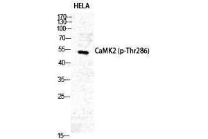 Western Blotting (WB) image for anti-CaMKIIalpha/delta (pThr286) antibody (ABIN3181941) (CaMKIIalpha/delta Antikörper  (pThr286))