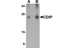 Western blot analysis of CDIP in human brain lysate with AP30220PU-N CDIP antibody at (A) 0. (CDIP1 Antikörper  (Center))