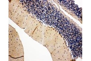 Immunohistochemistry (IHC) image for anti-Valosin Containing Protein (VCP) (C-Term) antibody (ABIN3029567)