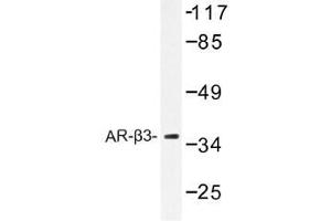 Image no. 1 for anti-Adrenergic, beta-3-, Receptor (ADRB3) antibody (ABIN317855) (ADRB3 Antikörper)
