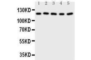 Western Blotting (WB) image for anti-Desmoglein 2 (DSG2) (AA 1104-1118), (C-Term) antibody (ABIN3042669) (Desmoglein 2 Antikörper  (C-Term))