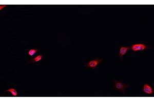ABIN6266483 staining MCF-7 cells by IF/ICC. (HNRNPD/AUF1 Antikörper  (Internal Region))