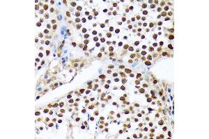 Immunohistochemistry of paraffin-embedded rat testis using PRP19 Rabbit mAb (ABIN7269505) at dilution of 1:100 (40x lens). (PRP19 Antikörper)
