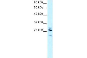 WB Suggested Anti-RGS20 Antibody Titration:  2. (RGS20 Antikörper  (Middle Region))