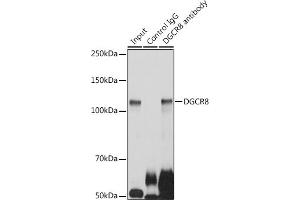 Immunoprecipitation analysis of 300 μg extracts of HeLa cells using 3 μg DGCR8 antibody (ABIN7266761). (DGCR8 Antikörper)