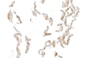Immunocytochemistry (ICC) image for anti-Syndecan 1 (SDC1) (AA 23-251) antibody (ABIN7795739) (Rekombinanter Syndecan 1 Antikörper  (AA 23-251))