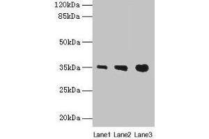 Western blot All lanes: PVRIG antibody at 4 μg/mL Lane 1: Mouse liver tissue Lane 2: Mouse kidney tissue Lane 3: Mouse heart tissue Secondary Goat polyclonal to rabbit IgG at 1/10000 dilution Predicted band size: 35 kDa Observed band size: 35 kDa (PVRIG Antikörper  (AA 193-326))