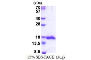 SDS-PAGE (SDS) image for Lectin, Galactoside-Binding, Soluble, 13 (LGALS13) (AA 1-139) protein (His tag) (ABIN5853458)