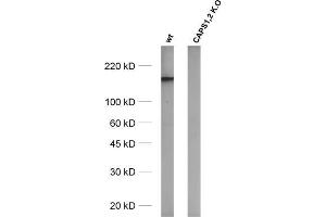 Western Blotting (WB) image for anti-Ca++-Dependent Secretion Activator (CADPS) (AA 18-107) antibody (ABIN1742520)