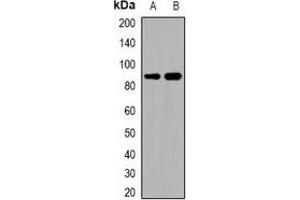 Western blot analysis of ADAM32 expression in HEK293T (A), human testis (B) whole cell lysates. (ADAM32 Antikörper)