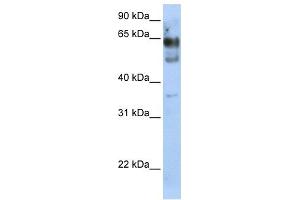 WB Suggested Anti-ZNF564 Antibody Titration:  0. (ZNF564 Antikörper  (N-Term))
