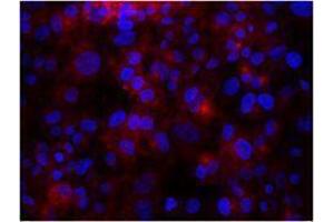 Immunofluorescence (IF) image for anti-Integrin beta 3 (ITGB3) antibody (ABIN2664787) (Integrin beta 3 Antikörper)