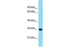 Western Blotting (WB) image for anti-Haloacid Dehalogenase-Like Hydrolase Domain Containing 3 (HDHD3) (C-Term) antibody (ABIN2791573) (HDHD3 Antikörper  (C-Term))