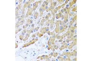 Immunohistochemistry of paraffin-embedded human liver using CCL8 antibody at dilution of 1:100 (40x lens).