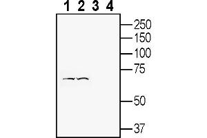 Western blot analysis of human Jurkat T-cell leukemia cell line lysate (lanes 1 and 3) and human SH-SY5Y neuroblastoma cell line lysate (lanes 2 and 4):1-2. (FLRT3 Antikörper  (Extracellular))