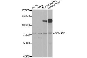 Western blot analysis of extracts of various cell lines, using SEMA3B Antibody. (SEMA3B Antikörper)