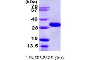 SDS-PAGE (SDS) image for OTU Domain, Ubiquitin Aldehyde Binding 2 (OTUB2) (AA 1-234) protein (His tag) (ABIN667440) (OTUB2 Protein (AA 1-234) (His tag))