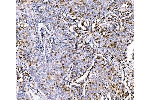 IHC analysis of Geminin/GMNN using anti-Geminin/GMNN antibody (ABIN7600598). (Geminin Antikörper  (AA 21-196))