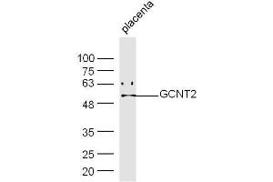 Mouse placenta lysates probed with Rabbit Anti-GCNT Polyclonal Antibody, Unconjugated  at 1:500 for 90 min at 37˚C. (GCNT2 Antikörper  (AA 151-250))