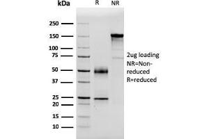 SDS-PAGE Analysis Purified PSA Mouse Monoclonal Antibody (APCS/3240). (APCS Antikörper  (AA 143-223))