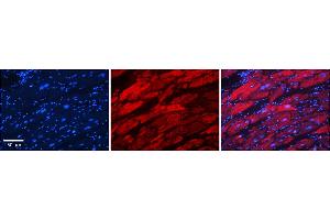 Immunohistochemistry (IHC) image for anti-Alanyl tRNA Synthetase (AARS) (C-Term) antibody (ABIN2778778)