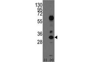 Western blot analysis of CD8A antibody and 293 cell lysate (2 ug/lane) either nontransfected (Lane 1) or transiently transfected with the CD8A gene (2).
