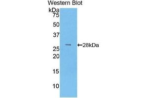 Detection of Recombinant LOXL3, Human using Polyclonal Antibody to Lysyl Oxidase Like Protein 3 (LOXL3) (LOXL3 Antikörper  (AA 519-726))