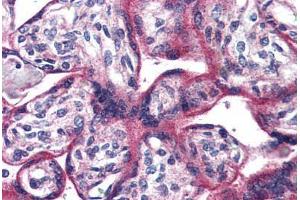 Placenta, Human: Formalin-Fixed, Paraffin-Embedded (FFPE) (ADCYAP1R1 Antikörper  (N-Term))
