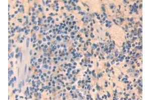 DAB staining on IHC-P; Samples: Mouse Spleen Tissue (MX1 Antikörper  (AA 43-308))
