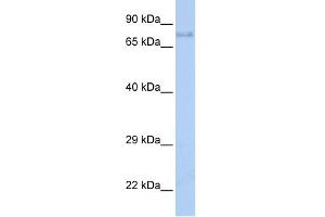 WB Suggested Anti-IGF1R Antibody Titration:  0. (IGF1R Antikörper  (Middle Region))