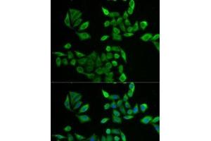 Immunofluorescence analysis of U2OS cells using PNP Polyclonal Antibody (PNP Antikörper)
