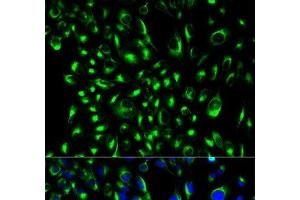 Immunofluorescence analysis of HeLa cells using LCP2 Polyclonal Antibody