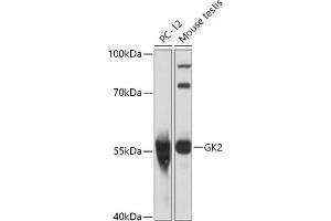 Western blot analysis of extracts of various cell lines, using GK2 antibody (ABIN7267458) at 1:1000 dilution. (GK2 Antikörper  (AA 1-150))