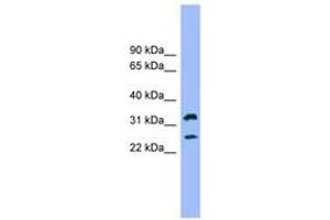 Image no. 1 for anti-Fc Fragment of IgE Receptor Ia (FCER1A) (AA 35-84) antibody (ABIN6744794) (Fc epsilon RI/FCER1A Antikörper  (AA 35-84))