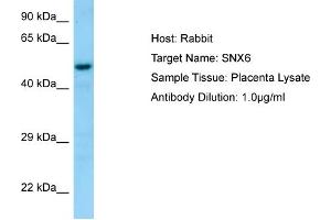 Host: Rabbit  Target Name: SNX6  Antibody Dilution: 1.