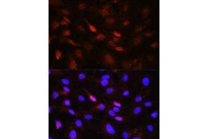 Immunofluorescence analysis of NIH/3T3 cells using Phospho-Jak1-Y1022/1023 antibody (ABIN6135246, ABIN6136118, ABIN6136119 and ABIN6225560) at dilution of 1:100. (JAK1 Antikörper  (pTyr1022, pTyr1023))