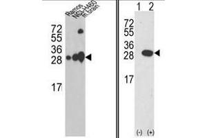 (LEFT) Western blot analysis of UCHL1 Antibody (C-term) in Ramos, NCI-H460 cell line and mouse brain tissue lysates (35ug/lane). (UCHL1 Antikörper  (C-Term))