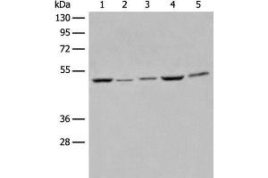 Western blot analysis of Raji Hela A549 HEPG2 and 231 cell lysates using EIF4A3 Polyclonal Antibody at dilution of 1:500 (EIF4A3 Antikörper)