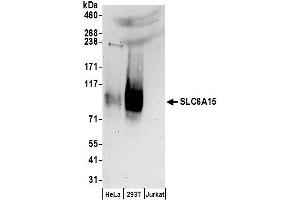 Western Blotting (WB) image for anti-Solute Carrier Family 6 (Neutral Amino Acid Transporter), Member 15 (SLC6A15) (AA 650-700) antibody (ABIN7450741)